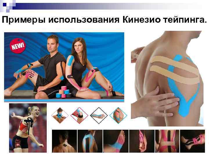 Примеры использования Кинезио тейпинга. 