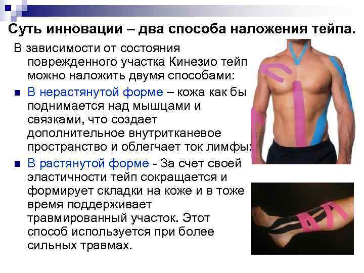 Суть инновации – два способа наложения тейпа. В зависимости от состояния  поврежденного участка