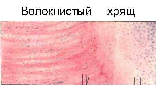 Волокнистый  хрящ 