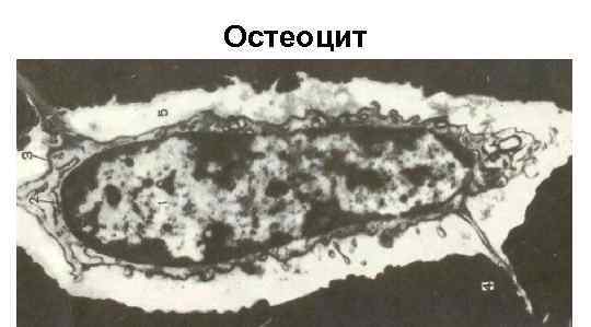 Остеоцит 