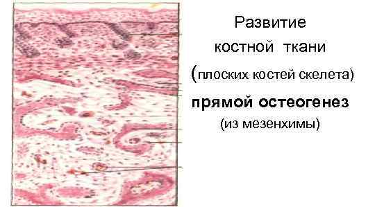  Развитие  костной ткани (плоских костей скелета) прямой остеогенез (из мезенхимы) 