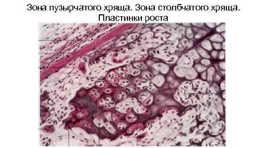 Зона пузырчатого хряща. Зона столбчатого хряща.   Пластинки роста 