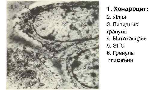 1. Хондроцит: 2. Ядра 3. Липидные гранулы 4. Митохондрии 5. ЭПС 6. Гранулы гликогена