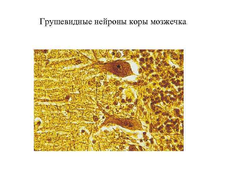 Грушевидные нейроны коры мозжечка 