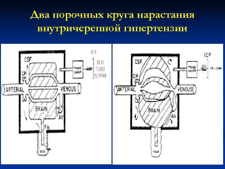 Два порочных круга нарастания внутричерепной гипертензии 