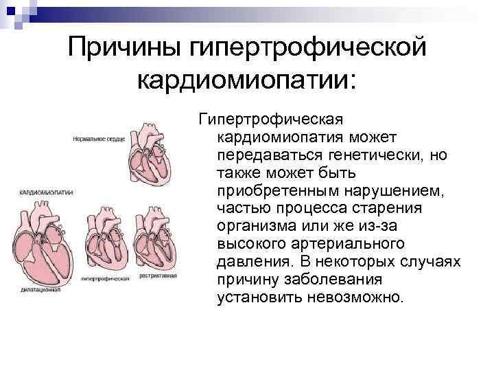 Перипортальная кардиомиопатия. Кардиомиопатия вызванная внешними причинами 142.7. Причины кардиомиопатии. Наследственные кардиомиопатии.