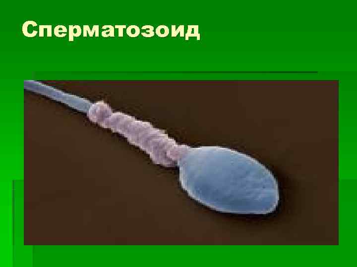 Сперматозоид 
