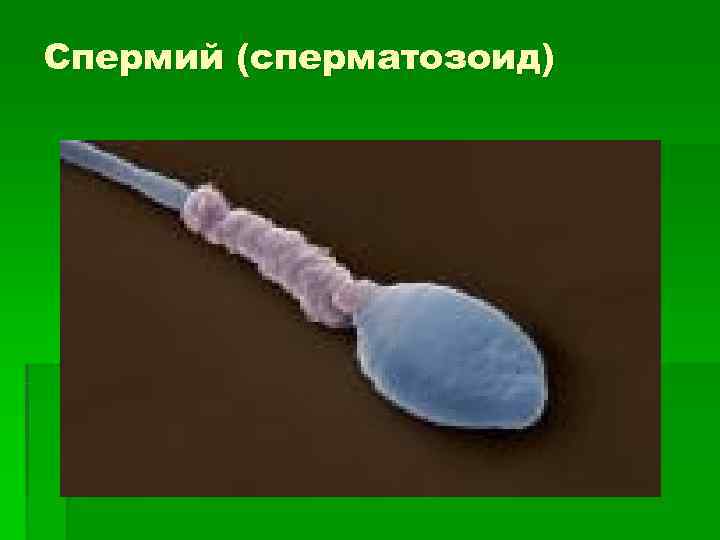 Спермий (сперматозоид) 