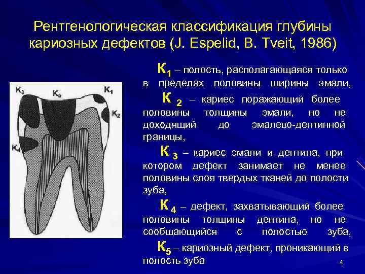 Клиническая картина кариеса