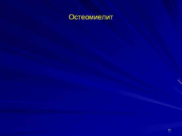 Остеомиелит    71 