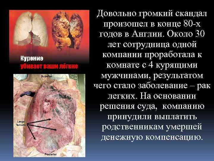  Довольно громкий скандал  произошел в конце 80 -х годов в Англии. Около