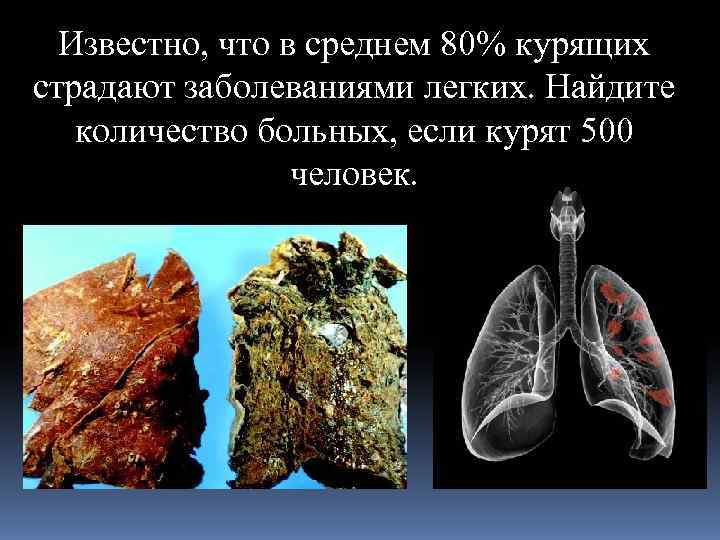  Известно, что в среднем 80% курящих страдают заболеваниями легких. Найдите  количество больных,
