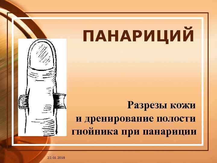    ПАНАРИЦИЙ      Разрезы кожи   