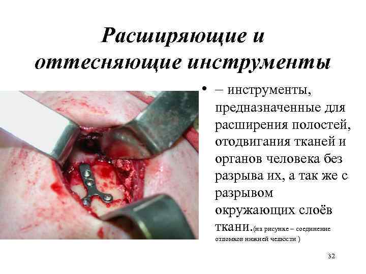  Расширяющие и оттесняющие инструменты    • – инструменты,   предназначенные