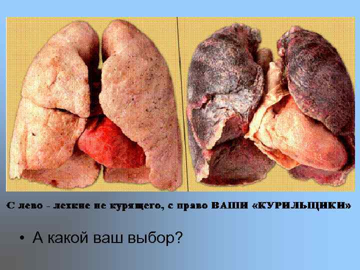  • А какой ваш выбор? 