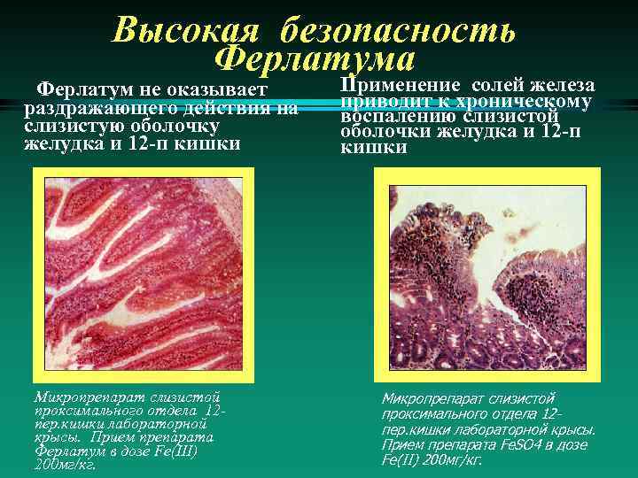 Высокая безопасность Ферлатума Ферлатум не оказывает раздражающего действия на слизистую оболочку желудка и 12