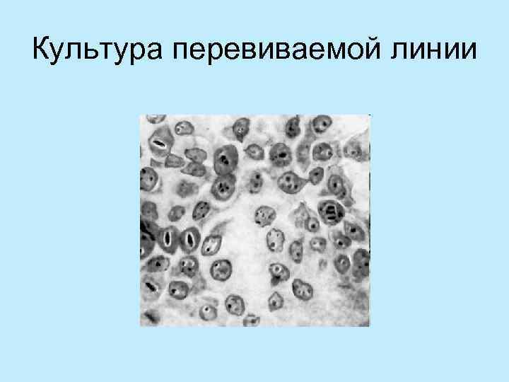 Культура перевиваемой линии 