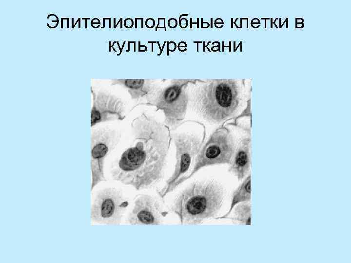 Эпителиоподобные клетки в  культуре ткани 
