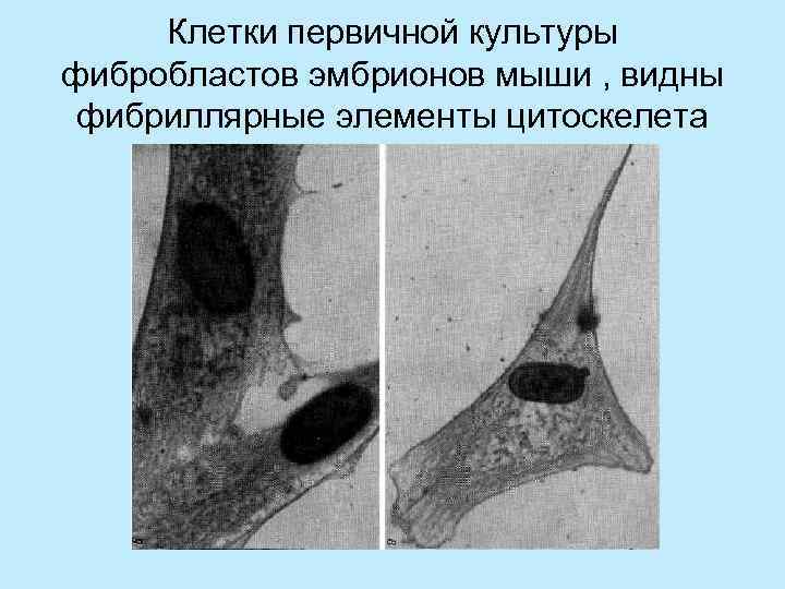  Клетки первичной культуры фибробластов эмбрионов мыши , видны фибриллярные элементы цитоскелета 