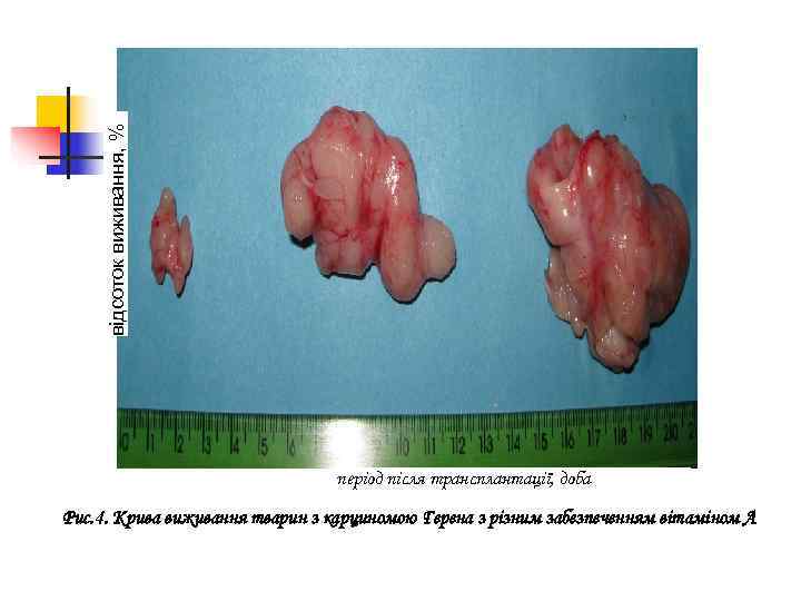  відсоток виживання, %       період після трансплантації, доба