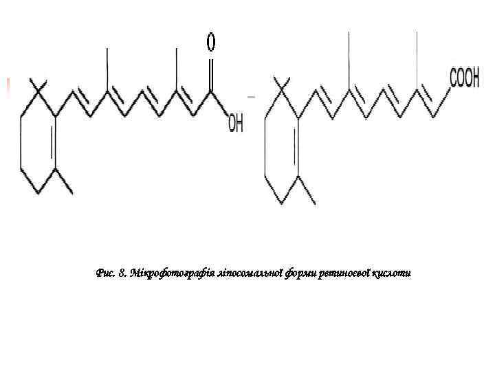 Рис. 8. Мікрофотографія ліпосомальної форми ретиноєвої кислоти 