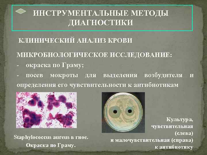        ИНСТРУМЕНТАЛЬНЫЕ МЕТОДЫ    ДИАГНОСТИКИ 