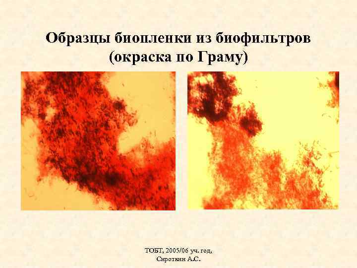 Образцы биопленки из биофильтров (окраска по Граму) ТОБТ, 2005/06 уч. год, Сироткин А. С.