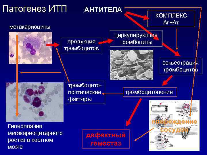 Патогенез ИТП АНТИТЕЛА КОМПЛЕКС Аг+Ат мегакариоциты продукция тромбоцитов циркулирующие тромбоциты секвестрация тромбоцитов тромбоцитопоэтические факторы