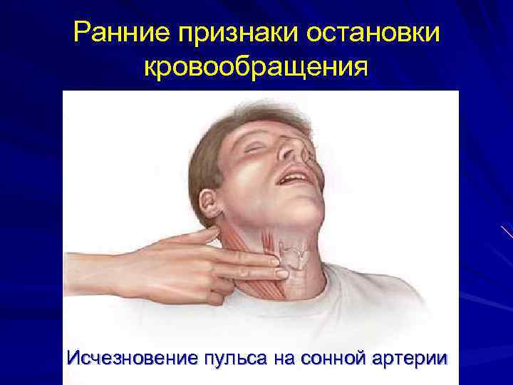 С какой стороны сонная артерия на шее у человека фото
