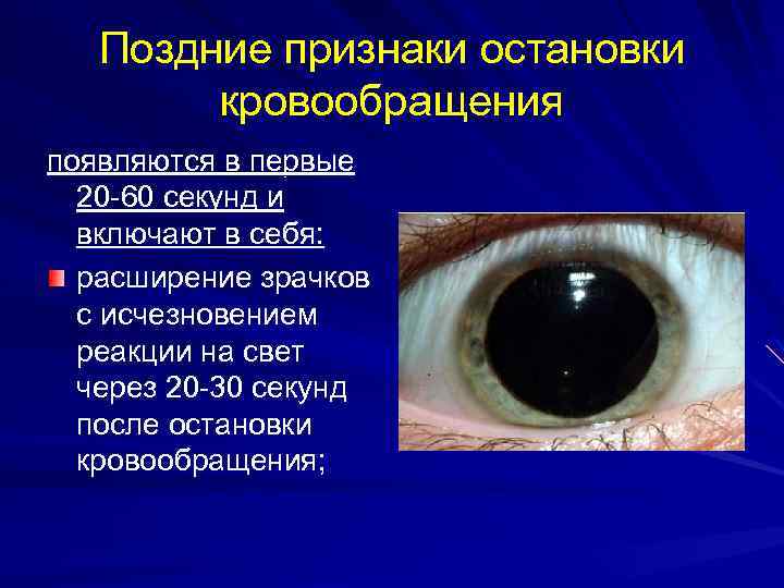 Поздние признаки остановки кровообращения появляются в первые 20 -60 секунд и включают в себя:
