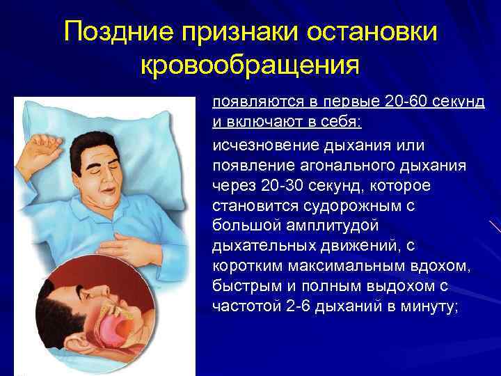 Поздние признаки остановки кровообращения появляются в первые 20 -60 секунд и включают в себя: