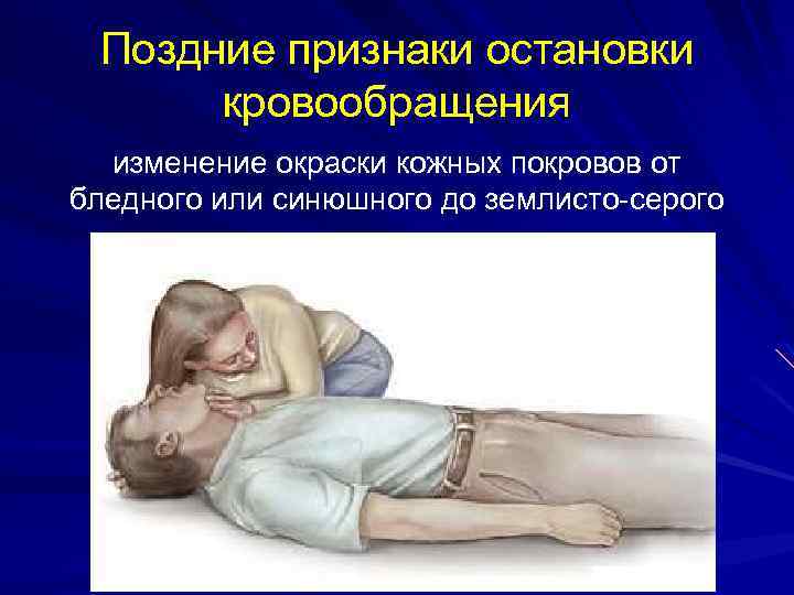 Поздние признаки остановки кровообращения изменение окраски кожных покровов от бледного или синюшного до землисто-серого