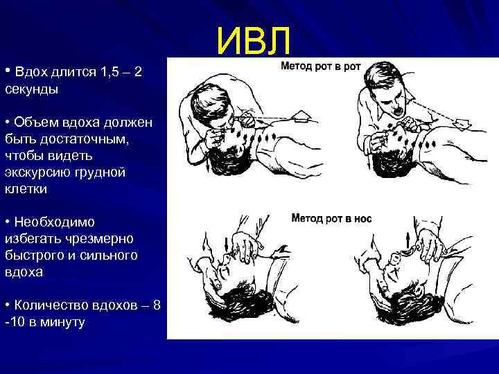 Ивл вест. Основы реаниматологии кратко. Проведение ИВЛ объем вдоха. Экскурсия грудной клетки при ИВЛ. Число вдыханий искусственной вентиляции.