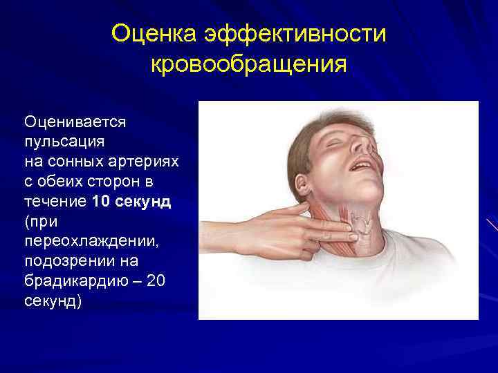 Оценка эффективности кровообращения Оценивается пульсация на сонных артериях с обеих сторон в течение 10