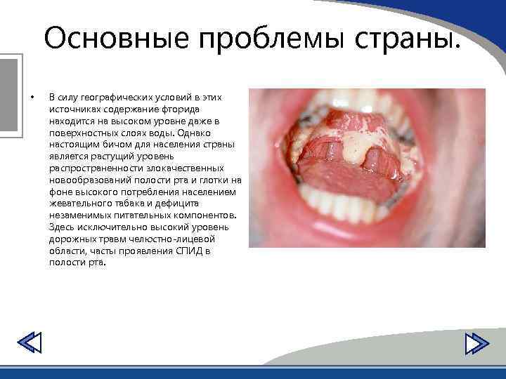 Основные проблемы страны. • В силу географических условий в этих источниках содержание фторида находится