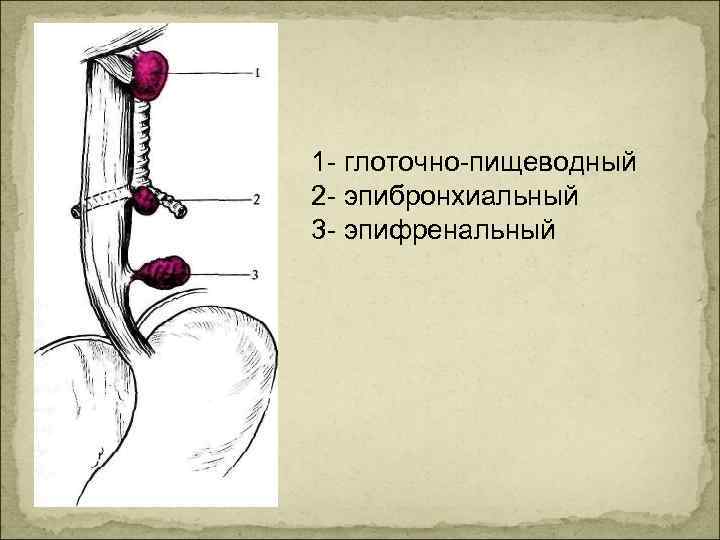 1 глоточно пищеводный 2 эпибронхиальный 3 эпифренальный 