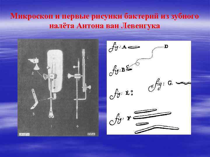 Микроскоп и первые рисунки бактерий из зубного налёта Антона ван Левенгука 