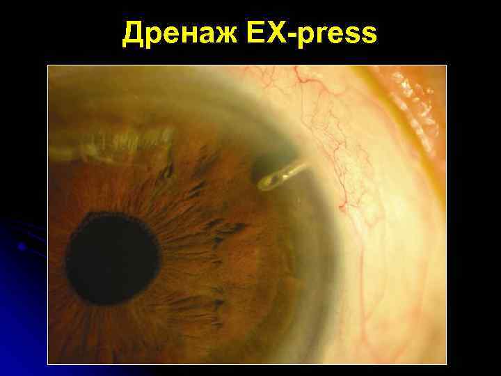 Дренаж EX-press 