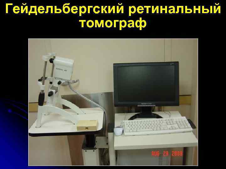Гейдельбергский ретинальный томограф 