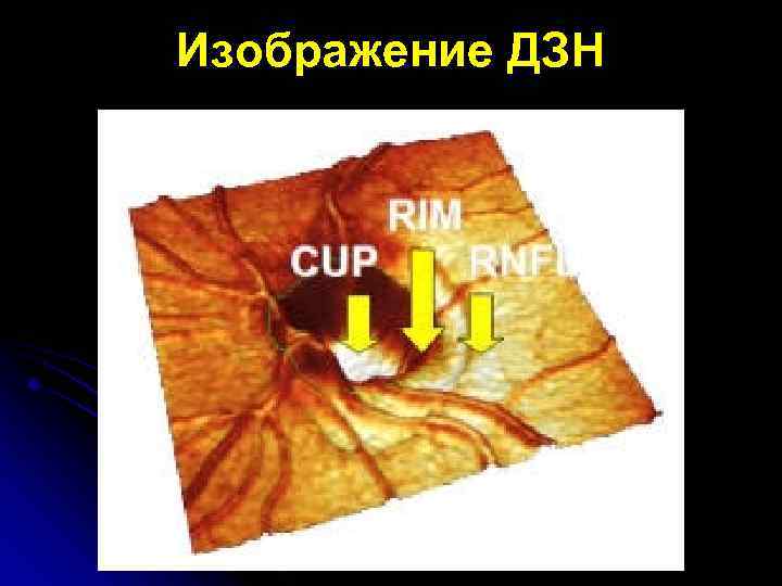 Изображение ДЗН 