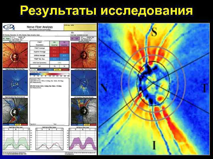 Результаты исследования 