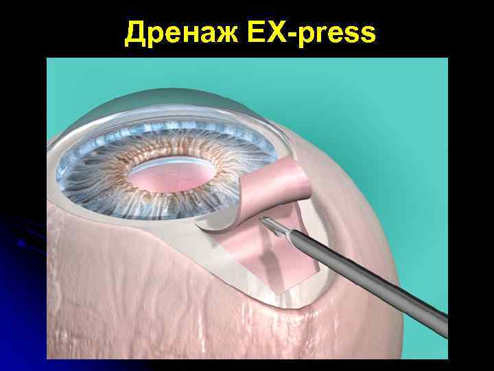  Дренаж EX-press 