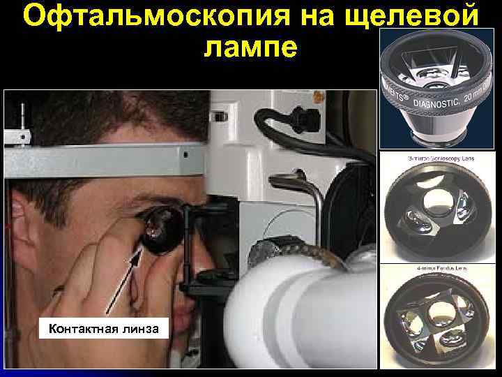 Офтальмоскопия на щелевой лампе Контактная линза 