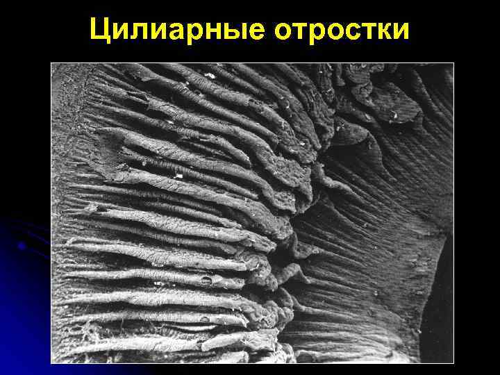 Цилиарные отростки 