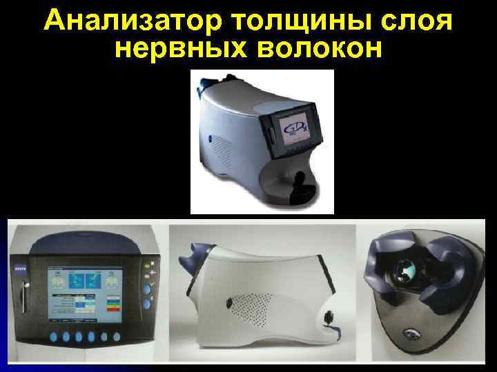 Анализатор толщины слоя нервных волокон 