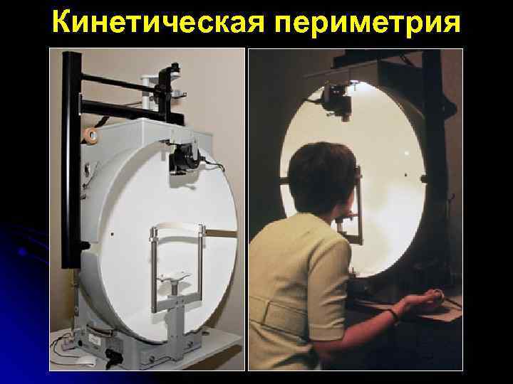 Кинетическая периметрия 