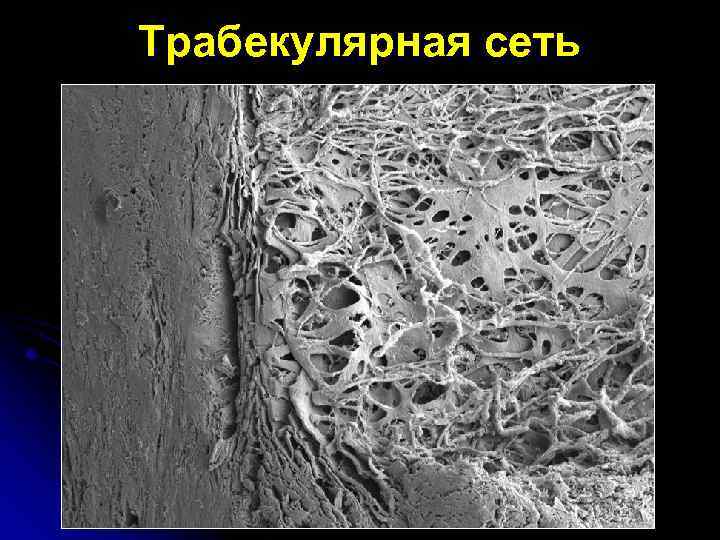 Трабекулярная сеть 