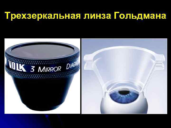 Трехзеркальная линза Гольдмана 