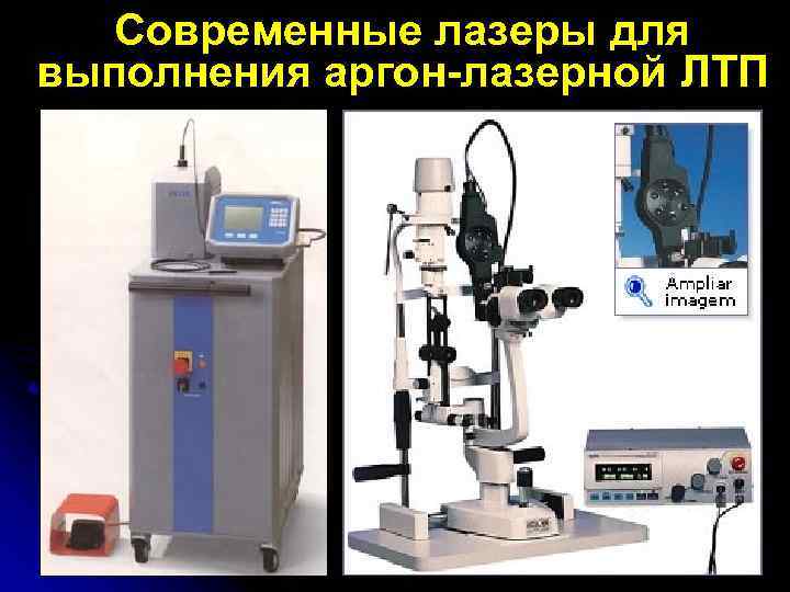 Современные лазеры для выполнения аргон-лазерной ЛТП 