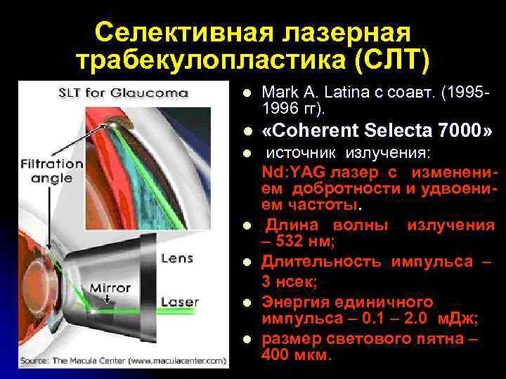 Селективная лазерная трабекулопластика (СЛТ) l Mark A. Latina с соавт. (19951996 гг). l «Coherent